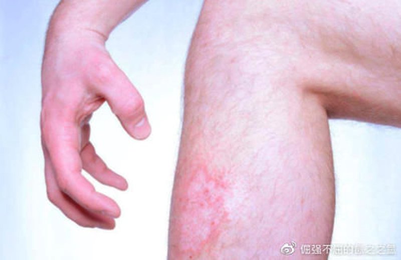皮肤科医院:守护美丽的新篇章